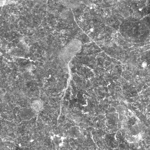 CIL:36431, Rattus norvegicus, astrocyte of the hippocampus, astrocyte