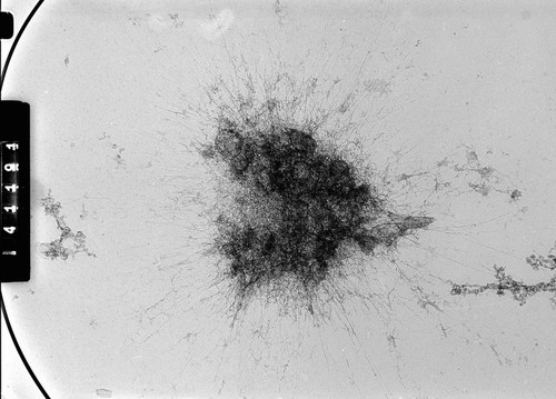 CIL:35382, Homo sapiens, cevical carcinoma