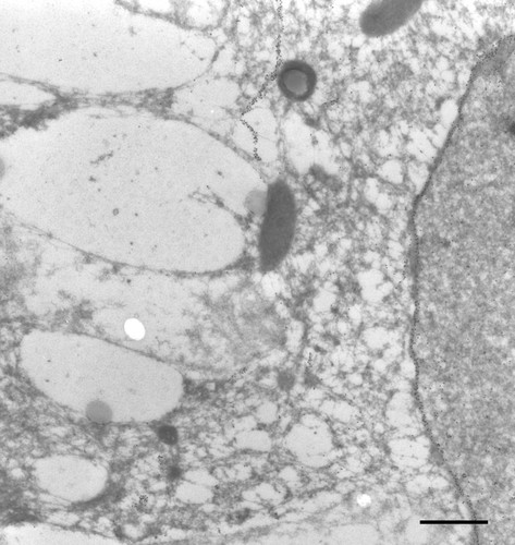 CIL:9856, Paramecium tetraurelia, cell by organism, eukaryotic cell, Eukaryotic Protist, Ciliated Protist