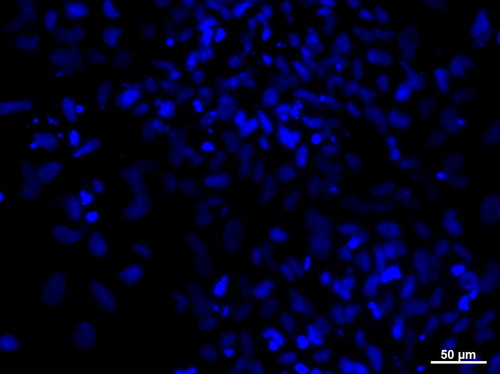 CIL: 54781, Homo sapiens, SBAD2 human iPSC line