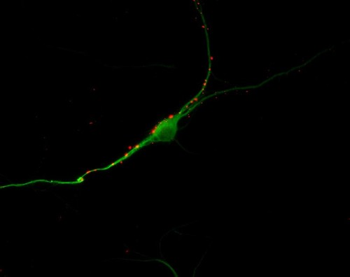 CIL:6223, Rattus, multipolar neuron