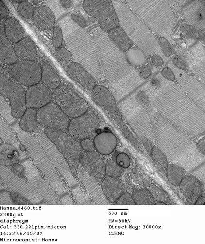 CIL:255, Mus musculus, skeletal muscle cell