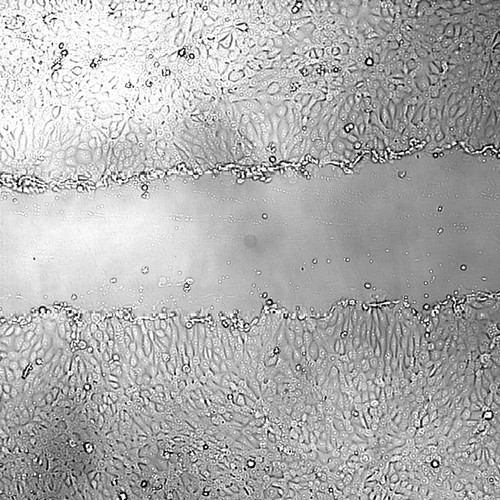 CIL:43408, Mus musculus, mammary adenocarcinoma