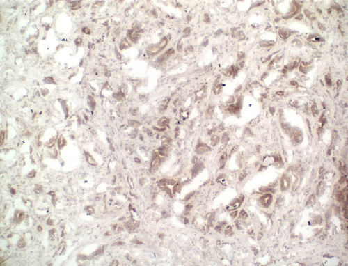 CIL:33211, Homo sapiens, endocrine-paracrine cell of prostate gland, basal cell of prostate epithelium, luminal cell of prostate epithelium, blood vessel endothelial cell, perineural cell, sheath cell, leukocyte, prostate stromal cell, smooth muscle cell of prostate