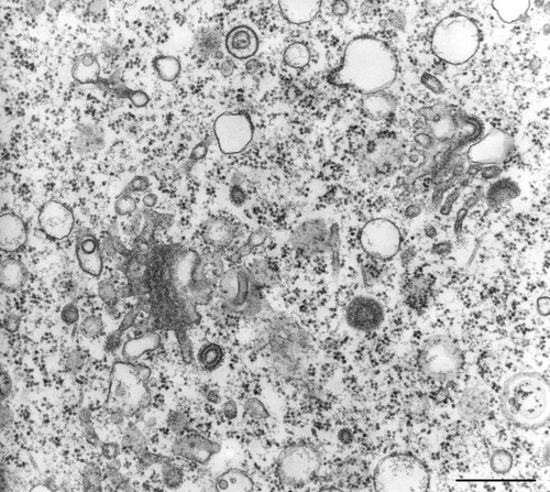 CIL:36264, Vorticella convallaria, cell by organism, eukaryotic cell, Eukaryotic Protist, Ciliated Protist