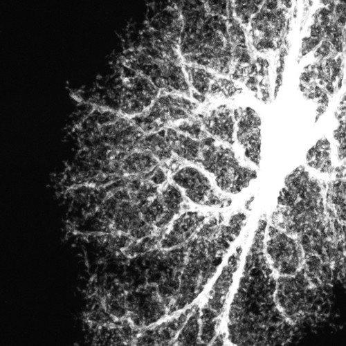 CIL:39944, Rattus norvegicus, astrocyte, astrocyte of the hippocampus