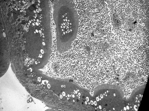 CIL:12651, Insect host: Graminella nigrifrons (Hemiptera, Cicadellidae), epithelial cell, bacteria