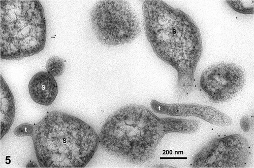 CIL:19127, Spiroplasma kunkelii, Zea mays, plant cell, prokaryotic cell