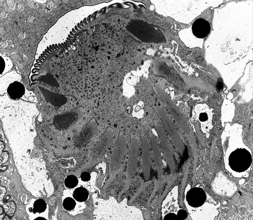 CIL:39138, Nassula, cell by organism, eukaryotic cell, Eukaryotic Protist, Ciliated Protist