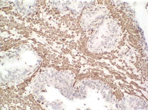 CIL:33478, Homo sapiens, endocrine-paracrine cell of prostate gland, basal cell of prostate epithelium, luminal cell of prostate epithelium, blood vessel endothelial cell, perineural cell, sheath cell, leukocyte, prostate stromal cell, smooth muscle cell of prostate