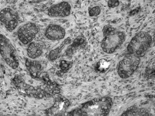 CIL:33665, Homo sapiens, endocrine-paracrine cell of prostate gland, basal cell of prostate epithelium, luminal cell of prostate epithelium, blood vessel endothelial cell, perineural cell, sheath cell, leukocyte, prostate stromal cell, smooth muscle cell of prostate