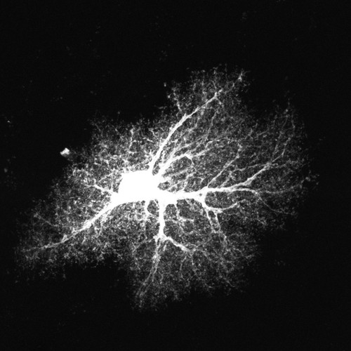 CIL:36371, Rattus norvegicus, astrocyte, astrocyte of the hippocampus