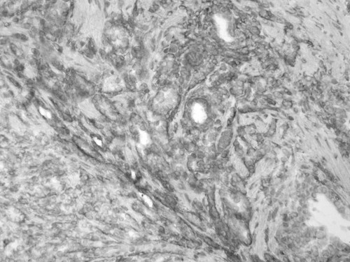 CIL:33968, Homo sapiens, endocrine-paracrine cell of prostate gland, basal cell of prostate epithelium, luminal cell of prostate epithelium, blood vessel endothelial cell, perineural cell, sheath cell, leukocyte, prostate stromal cell, smooth muscle cell of prostate