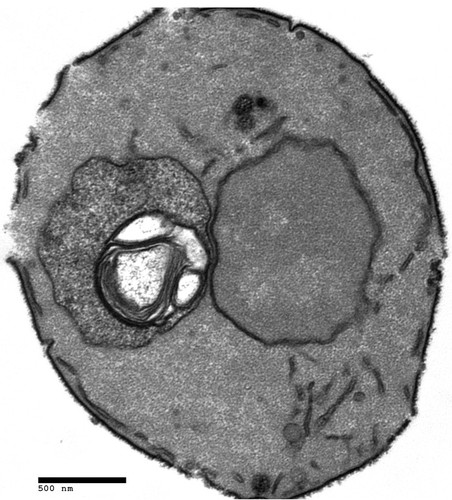 CIL:40424, Saccharomyces cerevisiae, dsr2Δ mutant