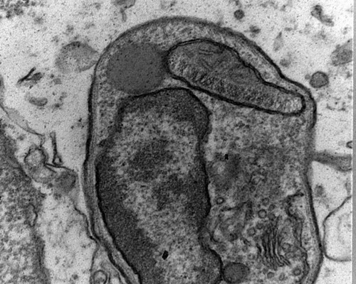 CIL: 54856, Leishmania infantum