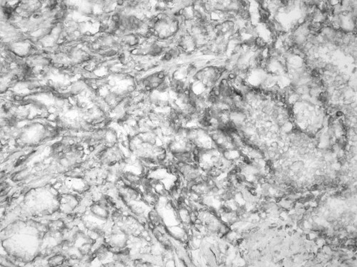 CIL:33949, Homo sapiens, endocrine-paracrine cell of prostate gland, basal cell of prostate epithelium, luminal cell of prostate epithelium, blood vessel endothelial cell, perineural cell, sheath cell, leukocyte, prostate stromal cell, smooth muscle cell of prostate