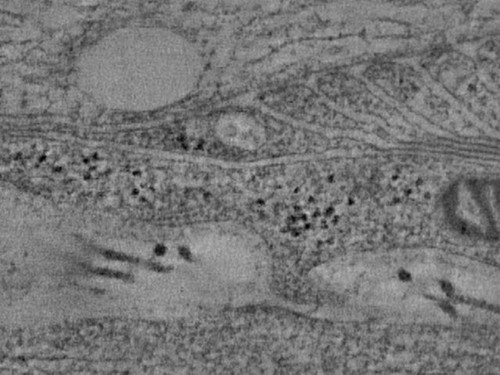 CIL:40167, Mus musculus, peripheral neuron, myelinating Schwann cell