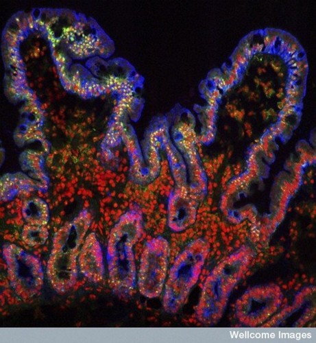 CIL:38903, Homo sapiens, epithelial cell of small intestine