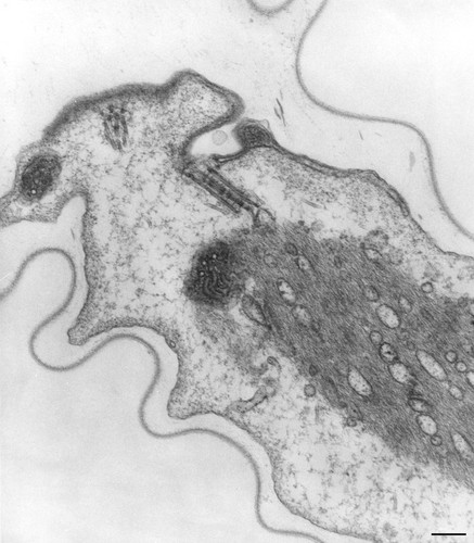 CIL:36282, Vorticella convallaria, cell by organism, eukaryotic cell, Eukaryotic Protist, Ciliated Protist