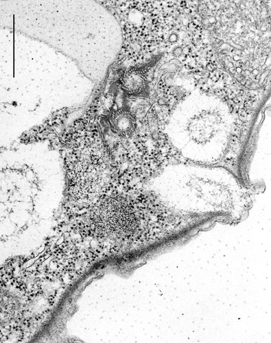 CIL:12109, Colpoda cucullus, cell by organism, eukaryotic cell, Eukaryotic Protist, Ciliated Protist