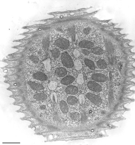 CIL:36270, Vorticella convallaria, cell by organism, eukaryotic cell, Eukaryotic Protist, Ciliated Protist