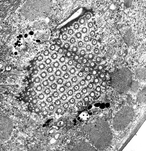 CIL:9805, Euplotes sp., cell by organism, eukaryotic cell, Eukaryotic Protist, Ciliated Protist