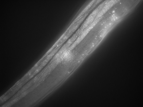 CIL:1021, Caenorhabditis elegans, muscle cell