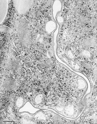 CIL:36788, Paramecium caudatum, cell by organism, eukaryotic cell, Eukaryotic Protist, Ciliated Protist