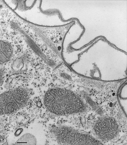 CIL:36602, Paramecium multimicronucleatum, cell by organism, eukaryotic cell, Eukaryotic Protist, Ciliated Protist