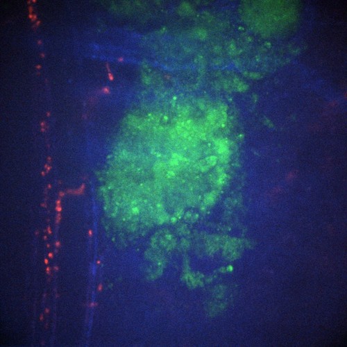 CIL:47677, Staphylococcus aureus, neutrophil, endothelial cell