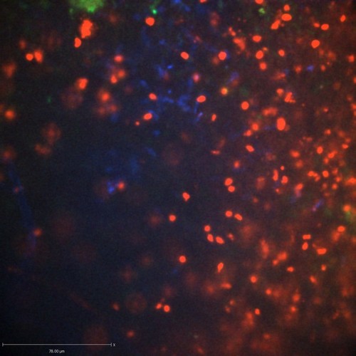 CIL:47308, Staphylococcus aureus, neutrophil, endothelial cell