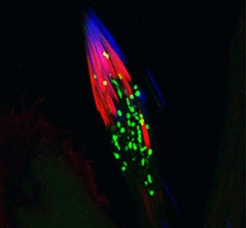 CIL:44651, Drosophila melanogaster, spermatid