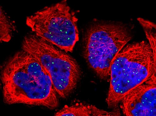 CIL:41678, Homo sapiens, epidermoid carcinoma