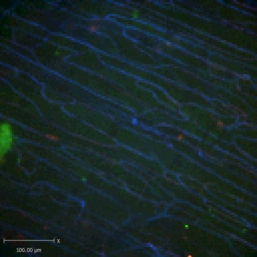 CIL:47581, Staphylococcus aureus, neutrophil, endothelial cell