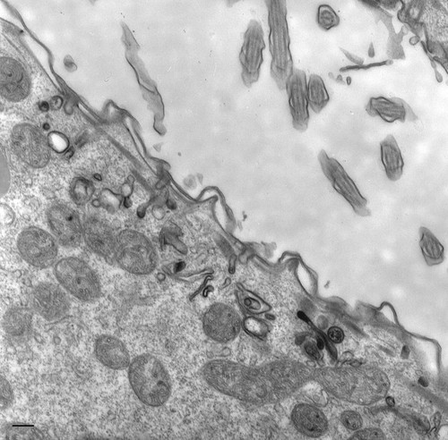 CIL:17444, Paramecium multimicronucleatum, cell by organism, eukaryotic cell, Eukaryotic Protist, Ciliated Protist