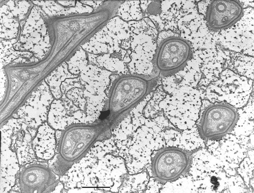 CIL:10370, Nassula, cell by organism, eukaryotic cell, Eukaryotic Protist, Ciliated Protist