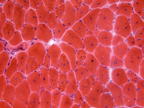 CIL:13600, Mus musculus, skeletal muscle cell