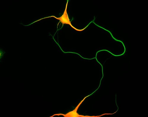 CIL:8464, Rattus, multipolar neuron