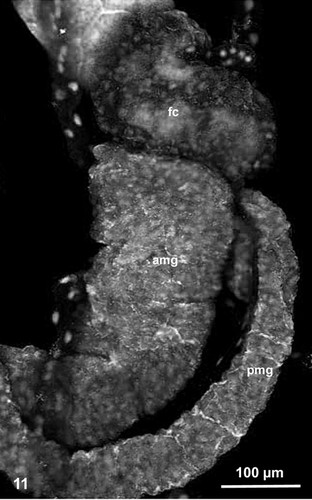 CIL:19118, Spiroplasma kunkelii, Dalbulus maidis, prokaryotic cell