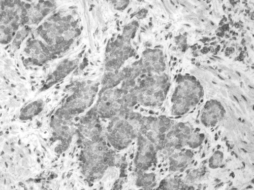 CIL:33683, Homo sapiens, endocrine-paracrine cell of prostate gland, basal cell of prostate epithelium, luminal cell of prostate epithelium, blood vessel endothelial cell, perineural cell, sheath cell, leukocyte, prostate stromal cell, smooth muscle cell of prostate