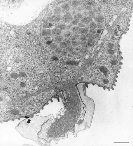 CIL:36280, Vorticella convallaria, cell by organism, eukaryotic cell, Eukaryotic Protist, Ciliated Protist