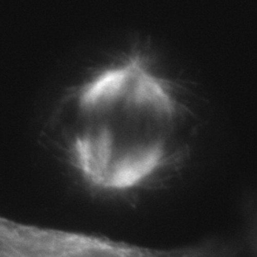 CIL:43759, Homo sapiens, epithelial cell