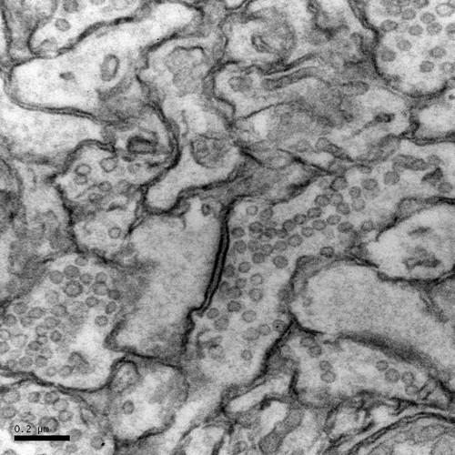 CIL:6230, Danio rerio, CNS neuron (sensu Vertebrata)