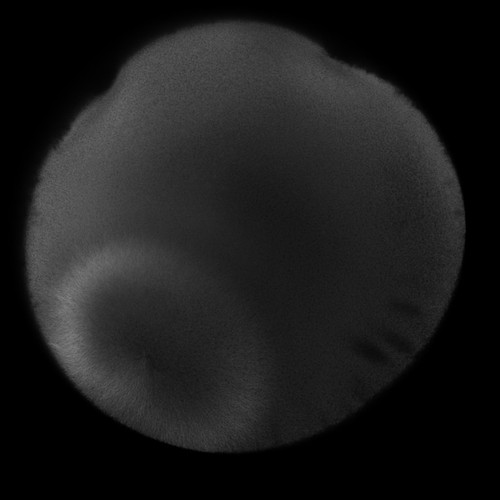 CIL:36464, Xenopus laevis, fertilized egg