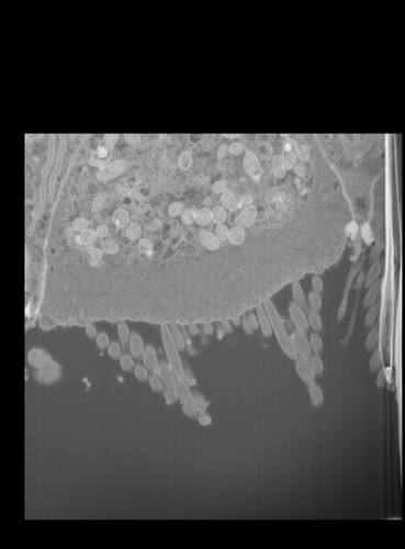 CIL:50681, FIB-SEM Dataset of anti-PKHD1L1 Immuno-Gold Labeled Outer Hair Cell Stereocilia Bundles