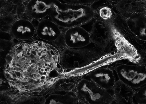 CIL:35167, Rattus rattus, podocyte (sensu Diptera), epithelial cell