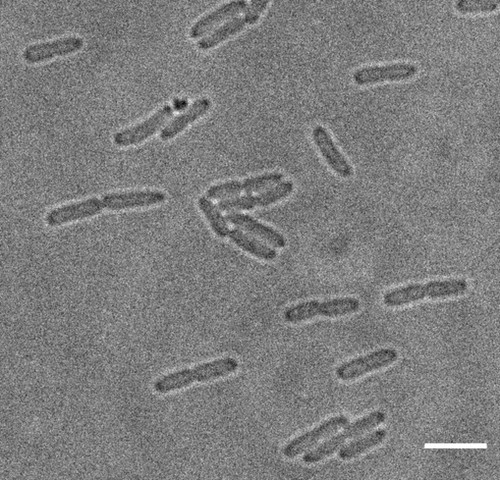 CIL: 54705, Bacteria E coli, MC1061