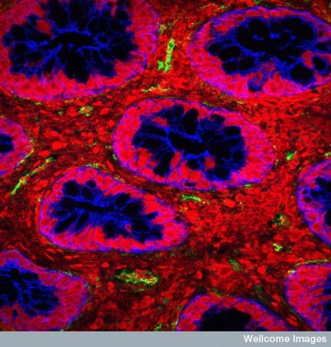 CIL:38952, Homo sapiens, Escherichia coli, endothelial cell