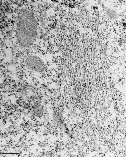 CIL:34617, Tetrahymena pyriformis, cell by organism, eukaryotic cell, Eukaryotic Protist, Ciliated Protist