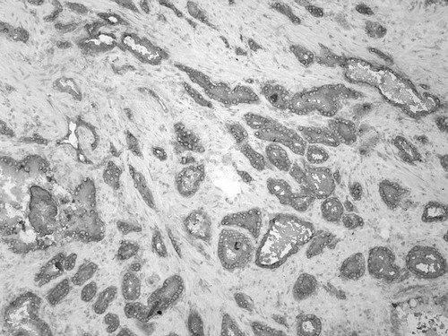 CIL:33545, Homo sapiens, endocrine-paracrine cell of prostate gland, basal cell of prostate epithelium, luminal cell of prostate epithelium, blood vessel endothelial cell, perineural cell, sheath cell, leukocyte, prostate stromal cell, smooth muscle cell of prostate